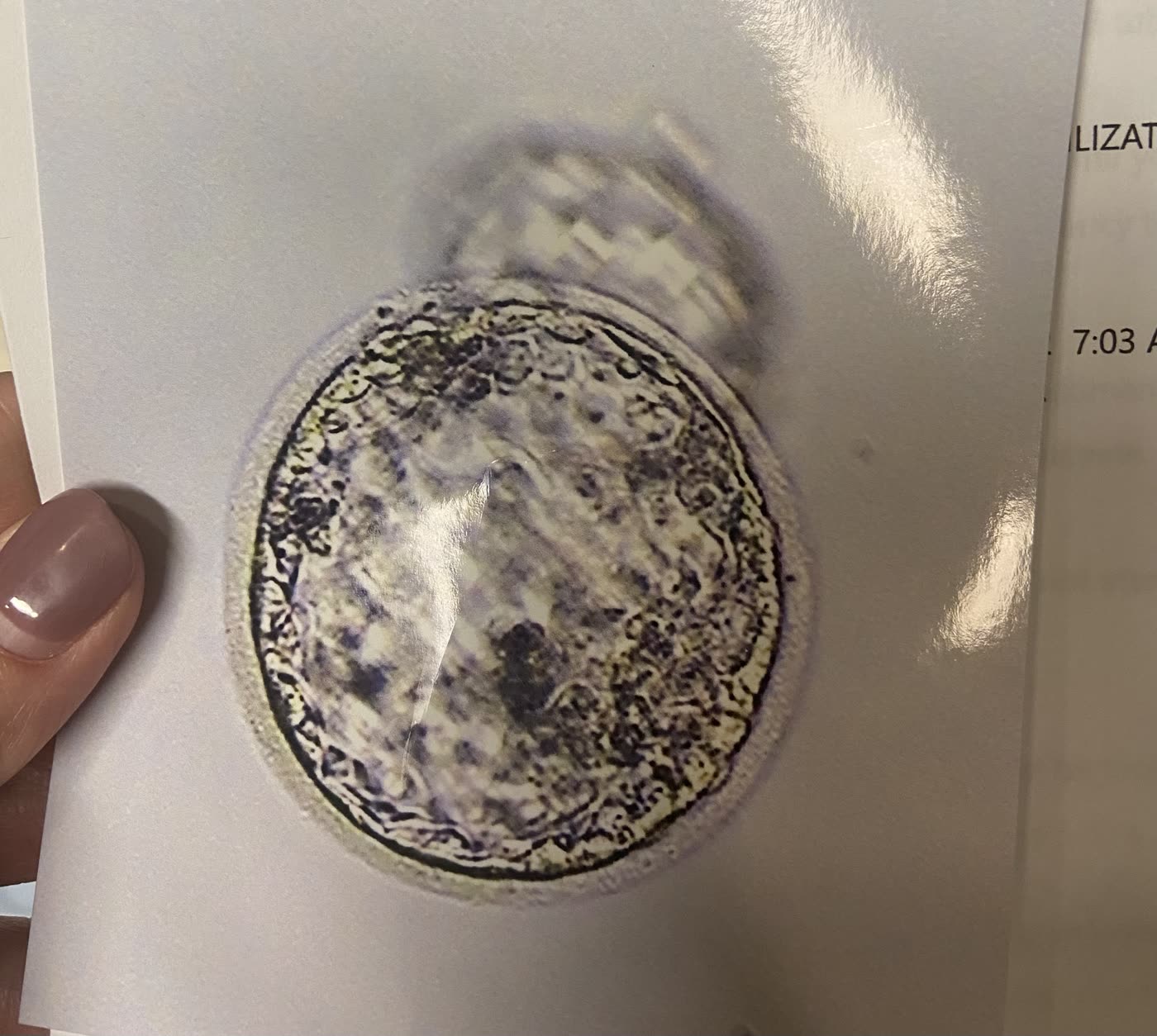 Personal photograph of our IVF embryo
